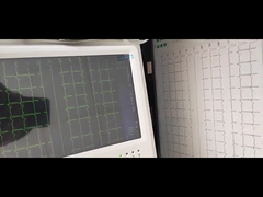 Touch Screen 12 Channel Medical ECG Machine Automatic