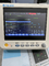 Moniteur Mini Ambulance Patient Monitor de multiparamètre de secours d'hôpital